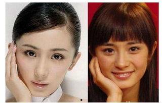 整容失败脸很鼓的网红吃瓜,美丽代价太大！